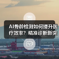 AI骨龄检测如何提升医疗效率?精准诊断新突破(图2) AI骨龄检测如何提升医疗效率?精准诊断新突破(图2)